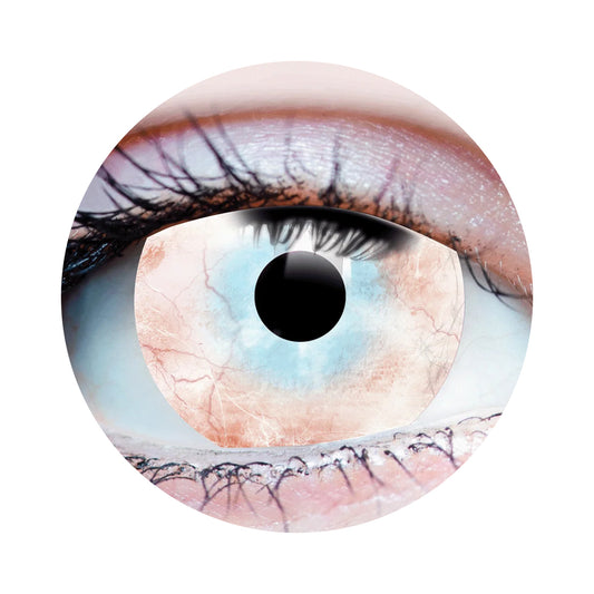 Plague Contacts